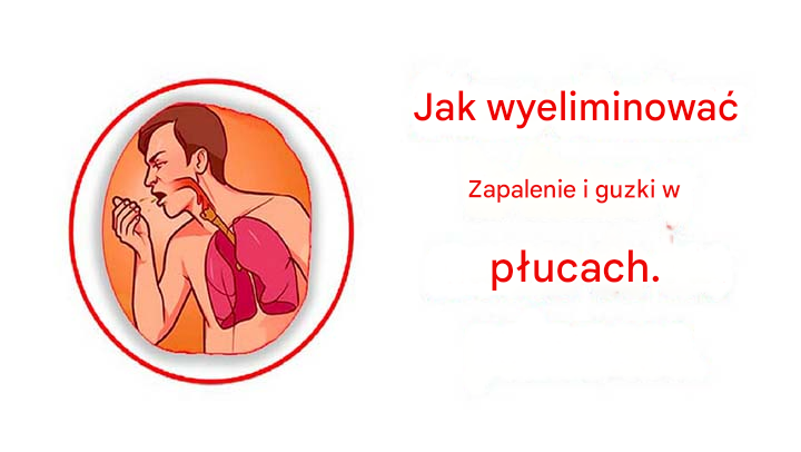 Lekarstwo na walkę z Moco i Tos z Flema de la Garganta i płucami