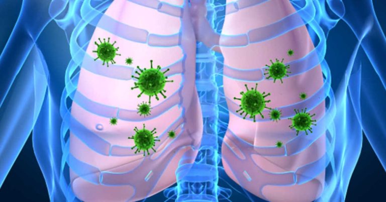 4 wskazówki, jak naturalnie oczyścić płuca i uniknąć chorób