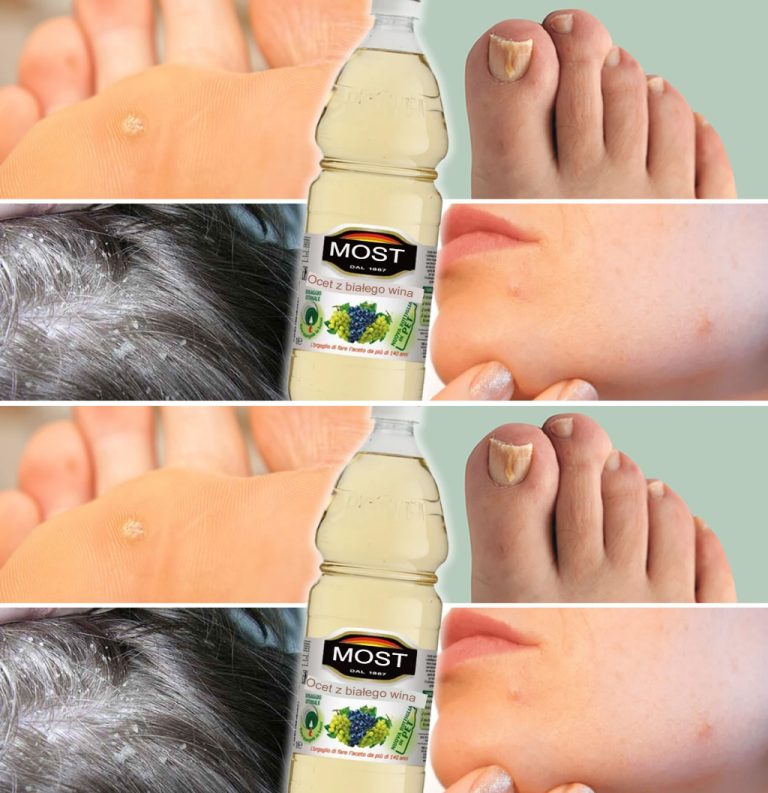 20 zastosowań octu, o których nie miałeś pojęcia