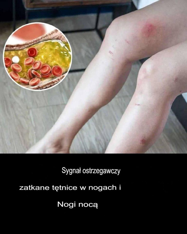 Zaburzenia krążenia – zagrożenie dla stóp