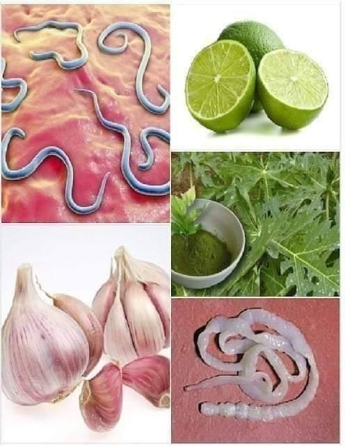 9 babcinych sposobów na pozbycie się robaków jelitowych (szybkie i skuteczne).