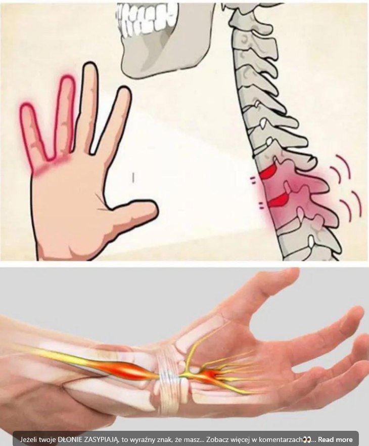 “Ciało Szepcze, Zanim Zacznie Krzyczeć: Mrowienie Palców a Zdrowie Twojego Kręgosłupa”