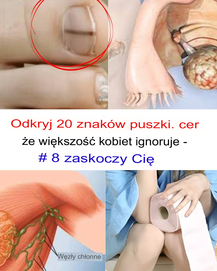 20 Objawów Raka, które Większość Kobiet Ignoruje – #8 Cię Zaskoczy