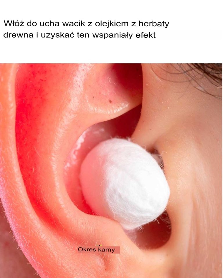 Umieść w uchu wacik nasączony olejkiem z drzewa herbacianego i poczuj ten niezwykły efekt.