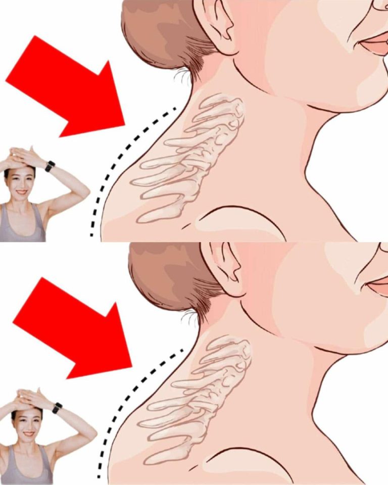 Chiropraktyk dzieli się 3 ćwiczeniami, które pomagają wyeliminować garb na plecach, wyprostować postawę ciała i złagodzić ból szyi.