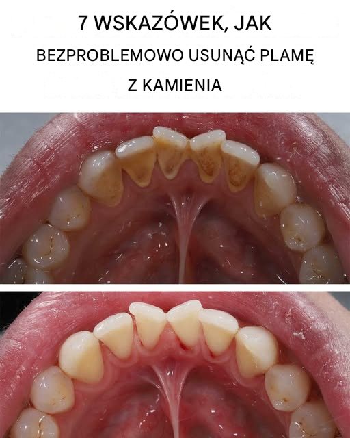7 genialnych wskazówek, jak usunąć plamy z kamienia wapiennego