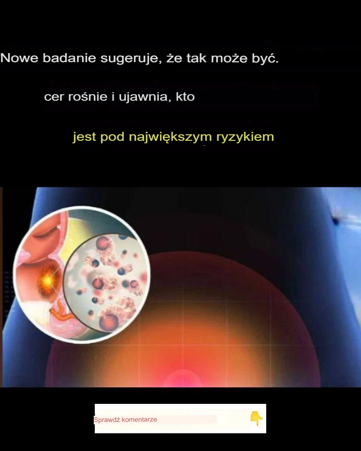 Badania wskazują, że zachorowalność na raka odbytu rośnie, ujawniając, kto jest najbardziej na niego narażony.