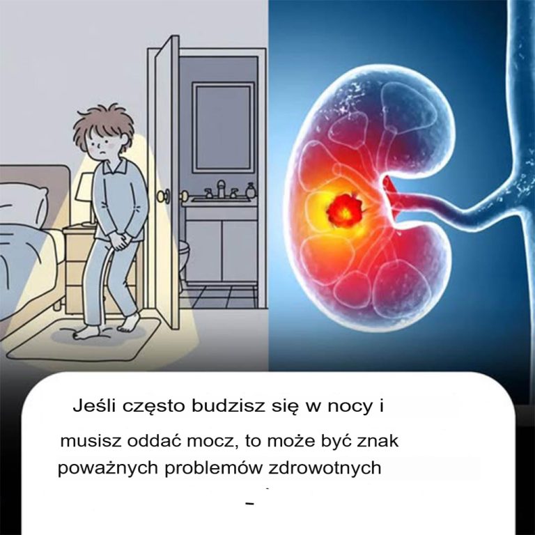 U osób, które budzą się w nocy częściej niż dwa razy, aby oddać mocz, może to być objawem tych problemów zdrowotnych