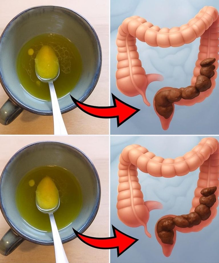 Środek oczyszczający jelito grube