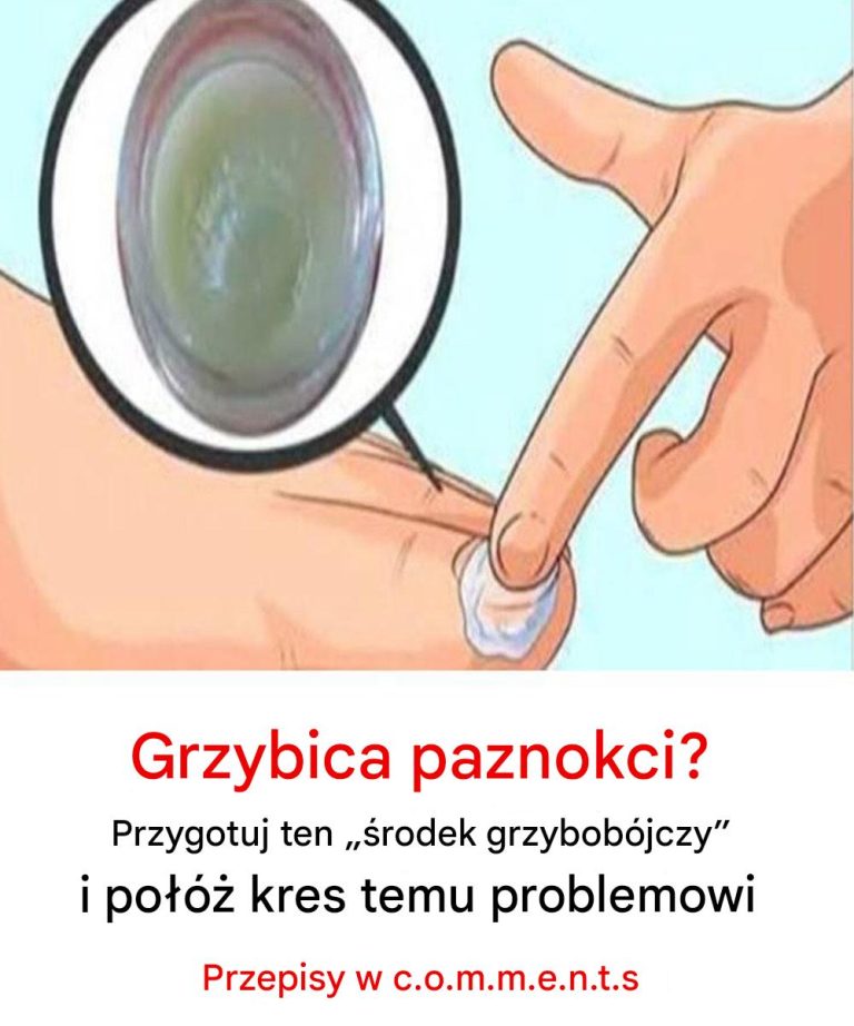 Grzybica paznokci? Przygotuj ten „fungus k.iller” i połóż kres temu problemowi