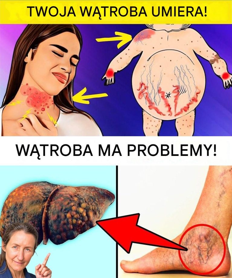 Co Twoje Stopy Mogą Ci Powiedzieć O Twoim Zdrowiu: Na Co Należy Zwracać Uwagę, W Tym Problemy Z Wątrobą