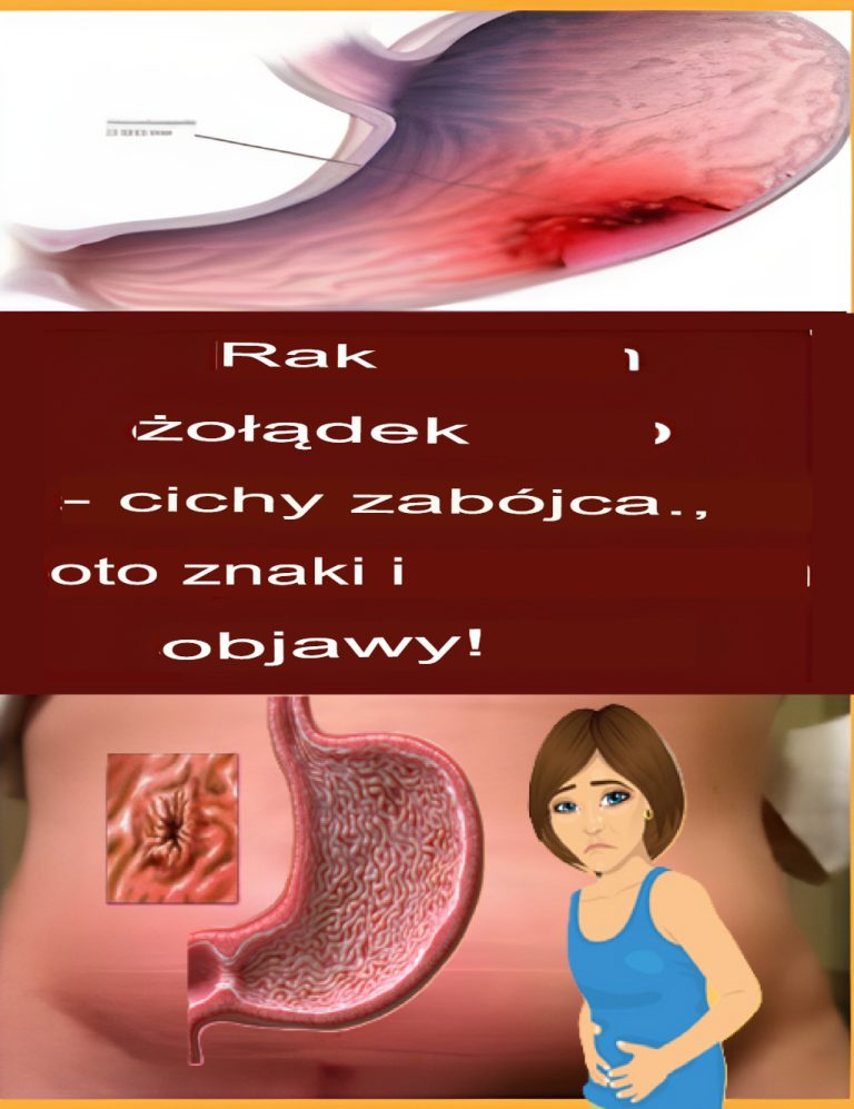 Rak Żołądka, Cichy Zabójca. Oto Znaki I Symptomy!