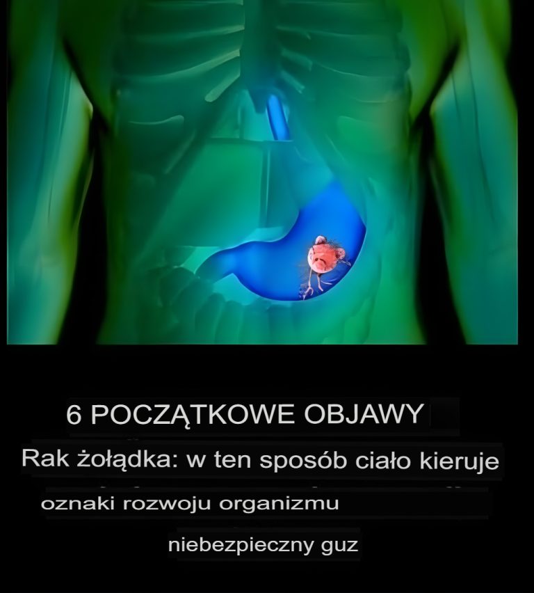 Rak żołądka: pierwsze objawy, których nigdy nie należy ignorować