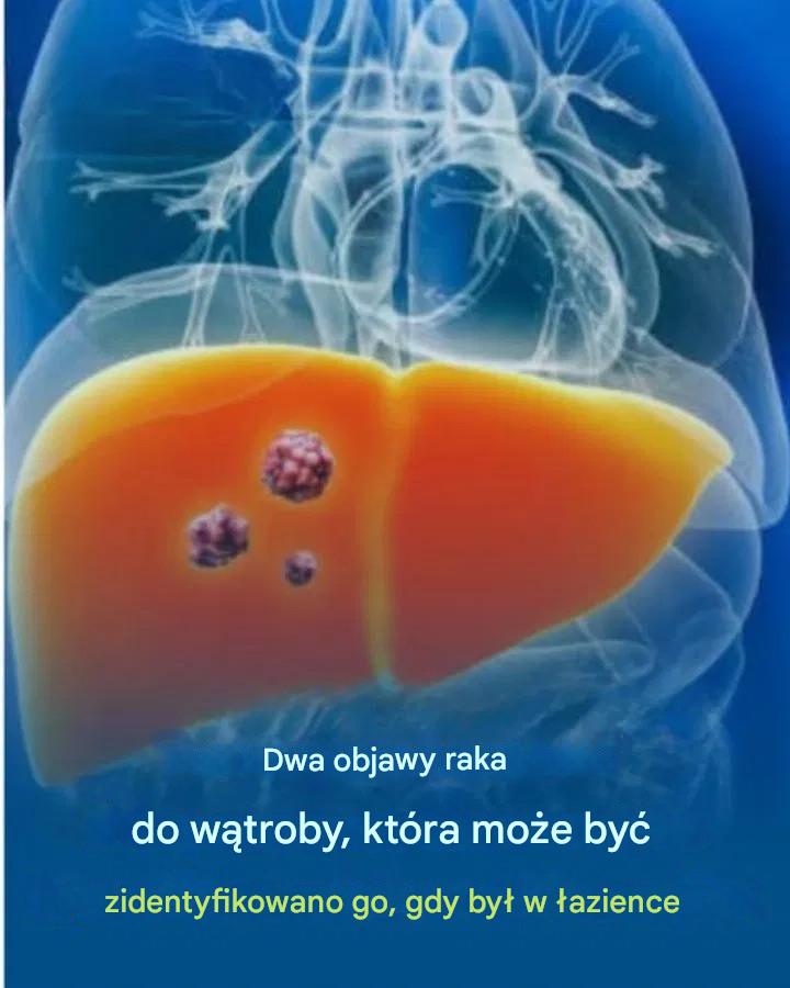 Dwa objawy raka wątroby, które można rozpoznać podczas korzystania z toalety. Więcej informacji w pierwszym komentarzu.