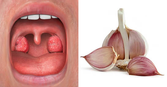 Jak zdezynfekować i oczyścić gardło czosnkiem