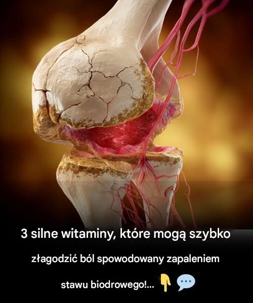 3 najlepsze witaminy na zapalenie stawu biodrowego – pożegnaj się z bólem stawu biodrowego