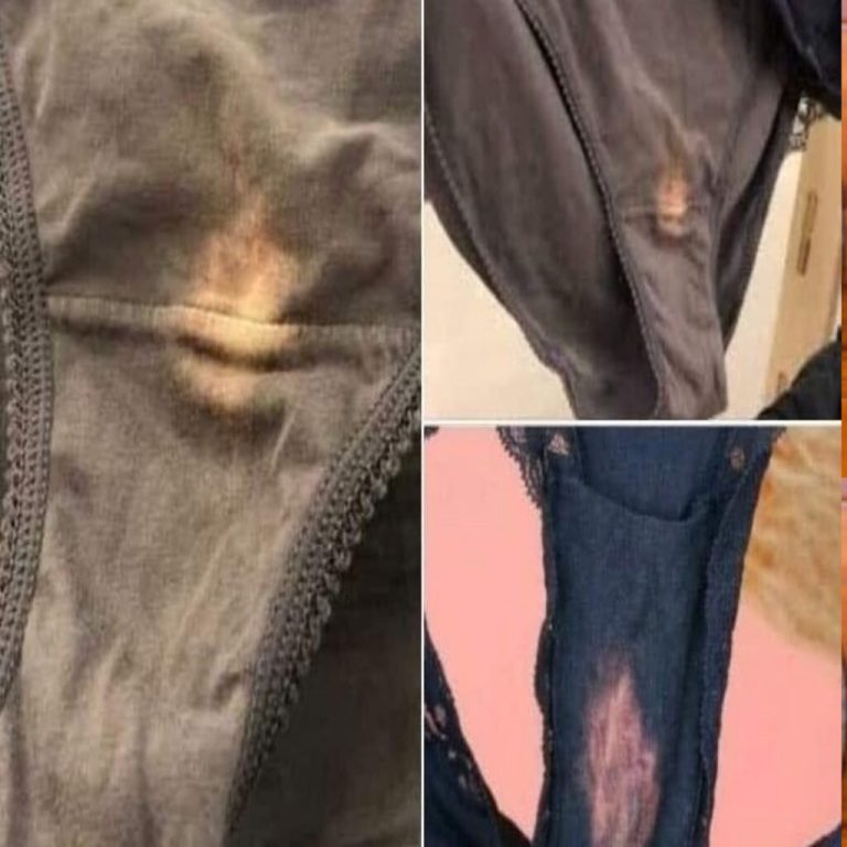 Jeśli znajdziesz na bieliźnie plamę z „wybielacza”, lepiej wiedz, co to oznacza 😮 Nie miałam pojęcia…