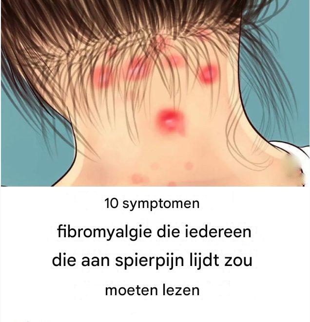 10 objawów fibromialgii, które powinien przeczytać każdy, kto cierpi na bóle mięśni