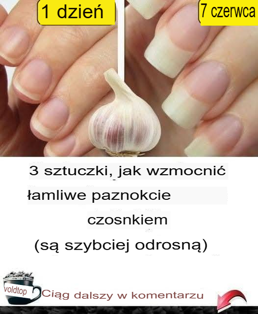 3 wskazówki, jak wzmocnić łamliwe paznokcie czosnkiem (odrosną szybciej)
