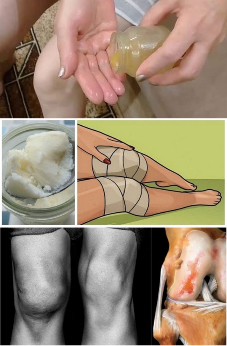 Naturalne rozwiązania dla osób cierpiących na bóle stawów i kolan