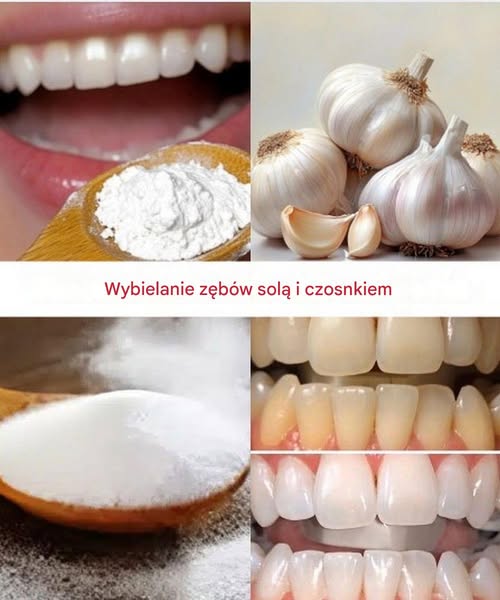 Jak wybielić zęby solą i czosnkiem?