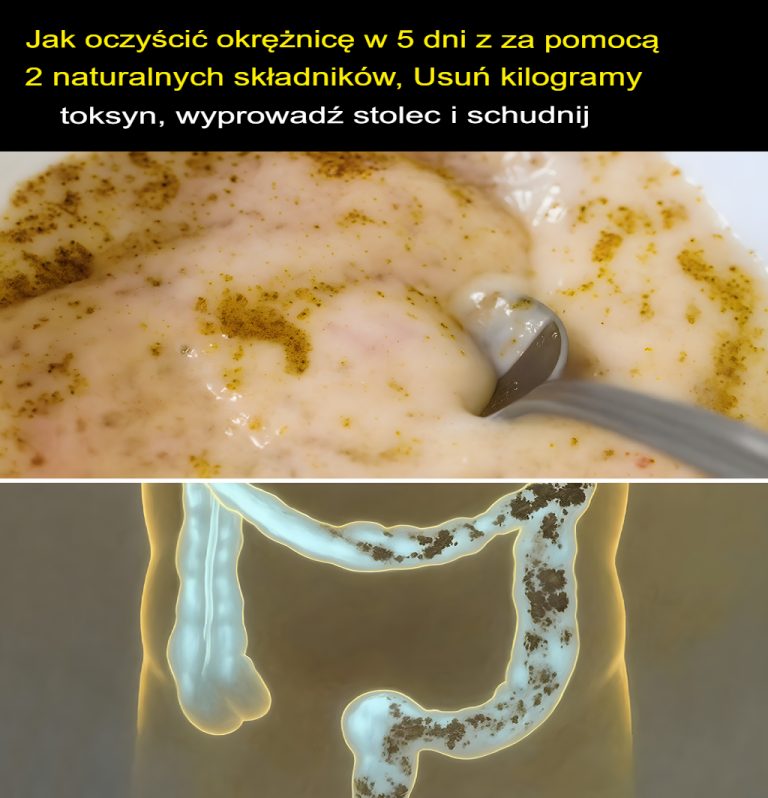 Jak oczyścić jelito grube w 5 dni za pomocą 2 naturalnych składników, usunąć kilogramy toksyn i mas kałowych oraz schudnąć