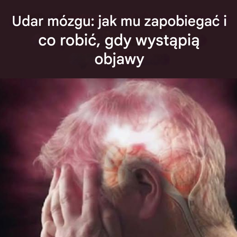Ktoś ma udar? Oto proste i bezpieczne kroki, które musisz podjąć, aby działać szybko.