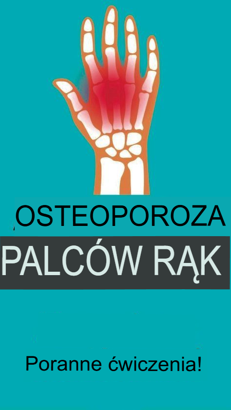 Cudowne lekarstwo na chorobę zwyrodnieniową stawów – czy powinieneś w to wierzyć? Kompletny przewodnik