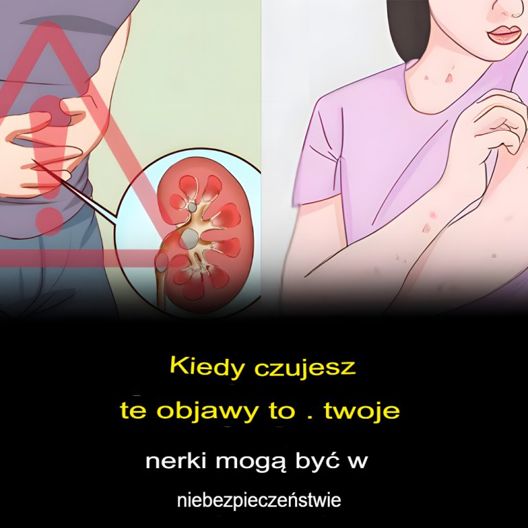 Wczesne objawy problemów z nerkami i jak się przed nimi chronić