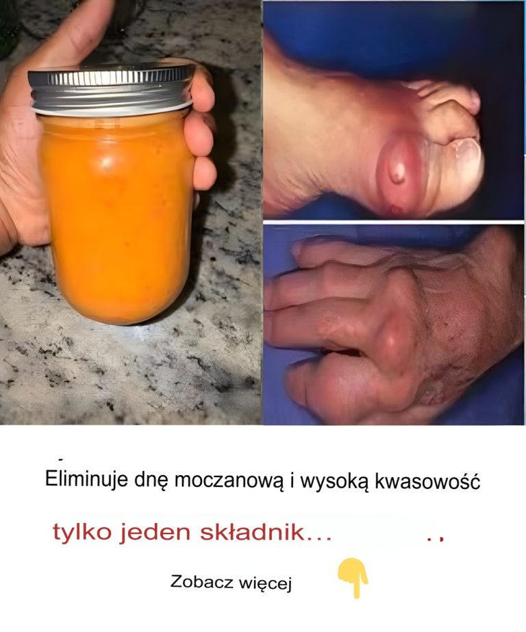 Korzystne działanie tego składnika na dnę moczanową i kwas moczowy.