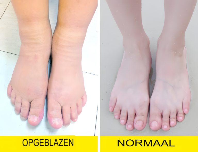 4 podstępne znaki na stopach, które wskazują na problem zdrowotny