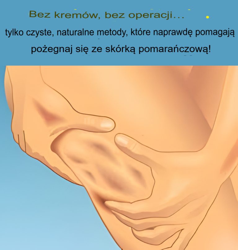 7 wskazówek, jak pozbyć się cellulitu naturalnie w domu