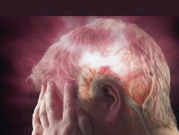 Udar mózgu: Jak mu zapobiegać i co robić, jeśli wystąpią objawy?