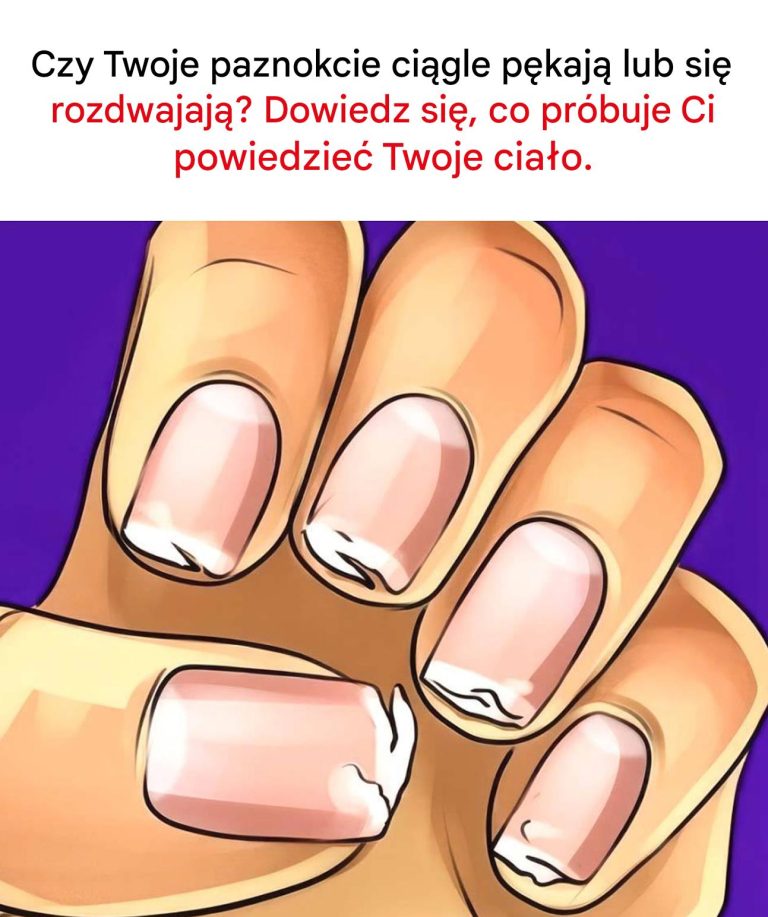 Czy Twoje paznokcie są łamliwe, pękają lub rozdwajają się regularnie? To nie jest błahostka: Twoje ciało wysyła Ci sygnał.