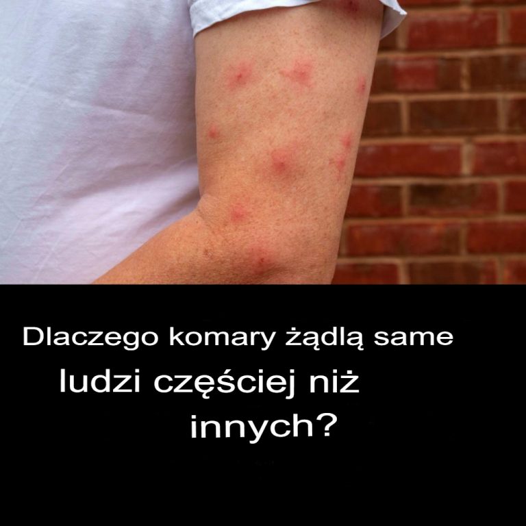 Dlaczego niektórzy ludzie żądlą bardziej niż inni?