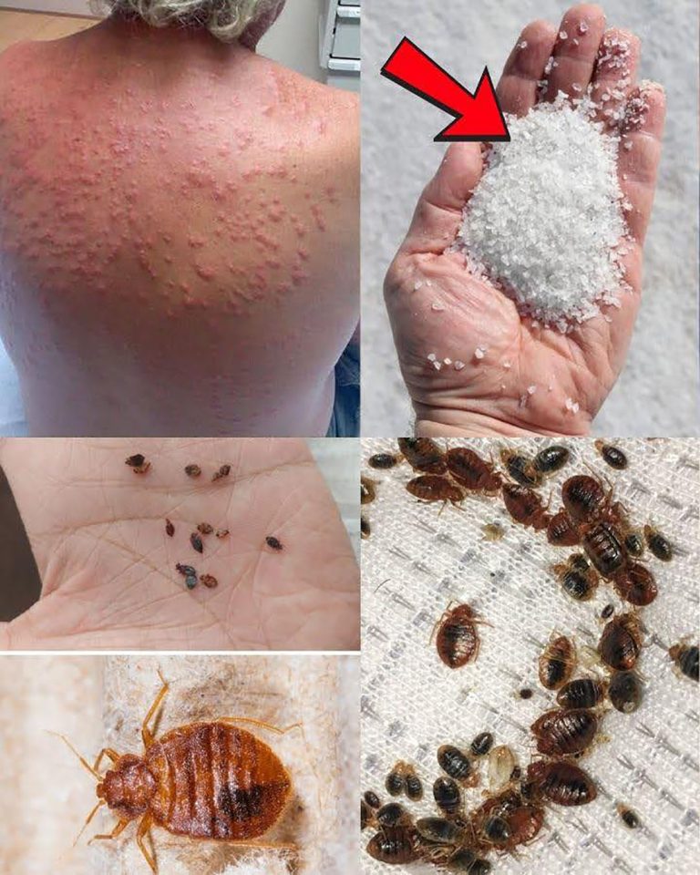 Jak pozbyć się pluskiew w domu?