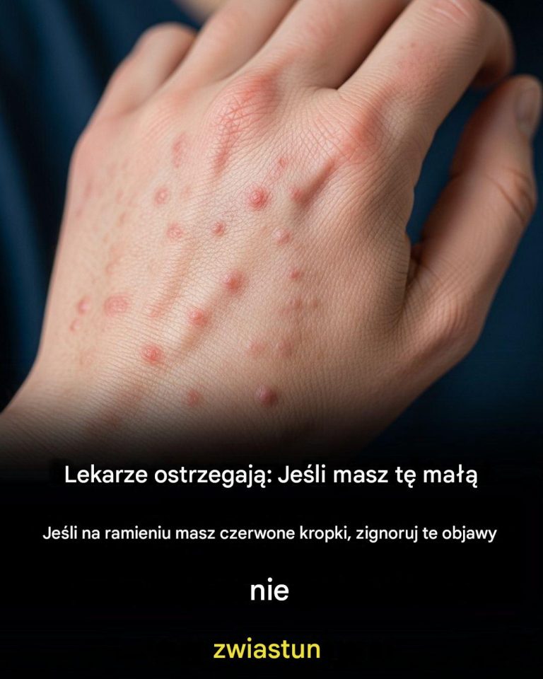 Nie ignoruj tych małych czerwonych plamek na ramieniu – mogą to być ważne sygnały ostrzegawcze