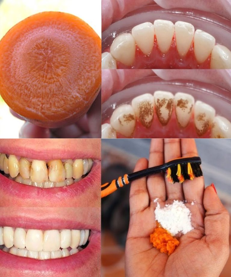 Promienny uśmiech dzięki dodatkom z marchewki? Naturalny trik ukryty w Twojej kuchni