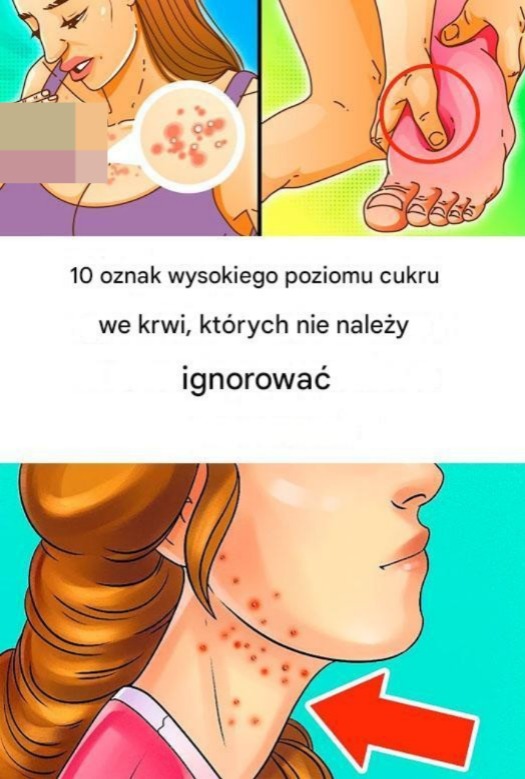 10 oznak, że jesz za dużo cukru