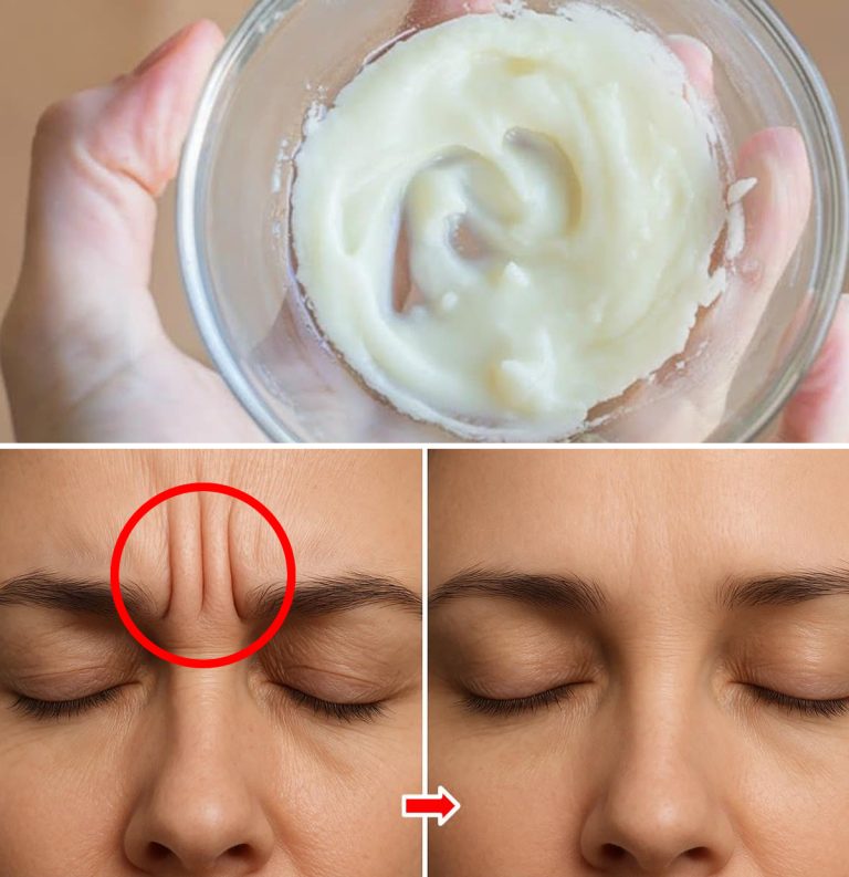 2 maski, aby wyeliminować zmarszczki między brwiami