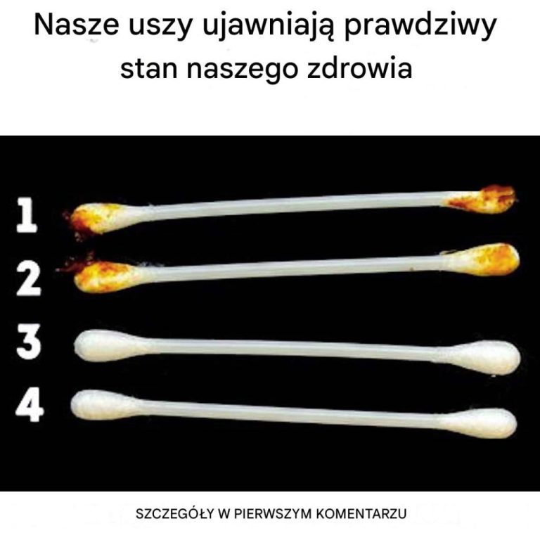 Nasze uszy ujawniają prawdziwy stan naszego zdrowia