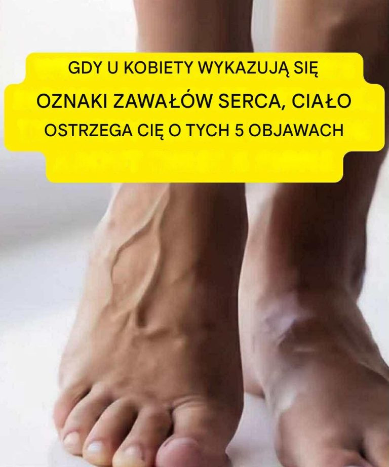 5 objawów u kobiet, które wskazują na zbliżający się atak serca